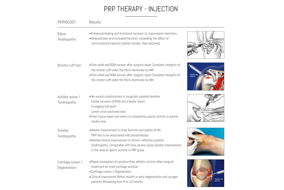 PRP THERAPY - INJECTION PRP THERAPY - INJECTION